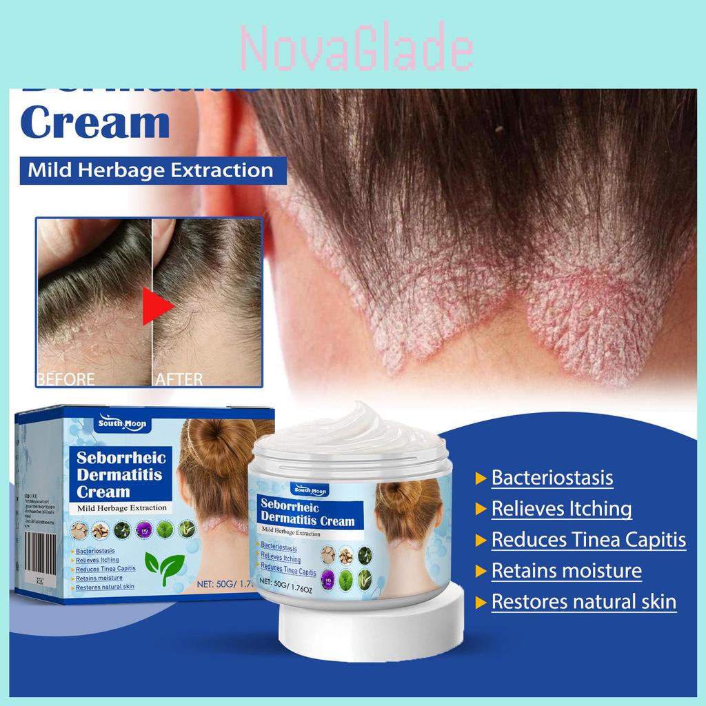 South Moon Seborrheic Dermatitis Cream Effective Relief For Scalp And Skin Problems