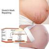 3x Stretch Marks Removal Cream Fat Growth Streaks Maternity Scars Acne Repair Increase Skin Elasticity Anti-wrinkle Firm Body Care