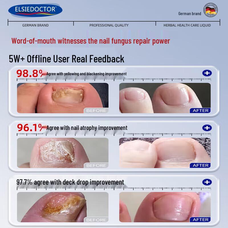 ELSIEDOCTOR Fungus Nail Treatment Solution