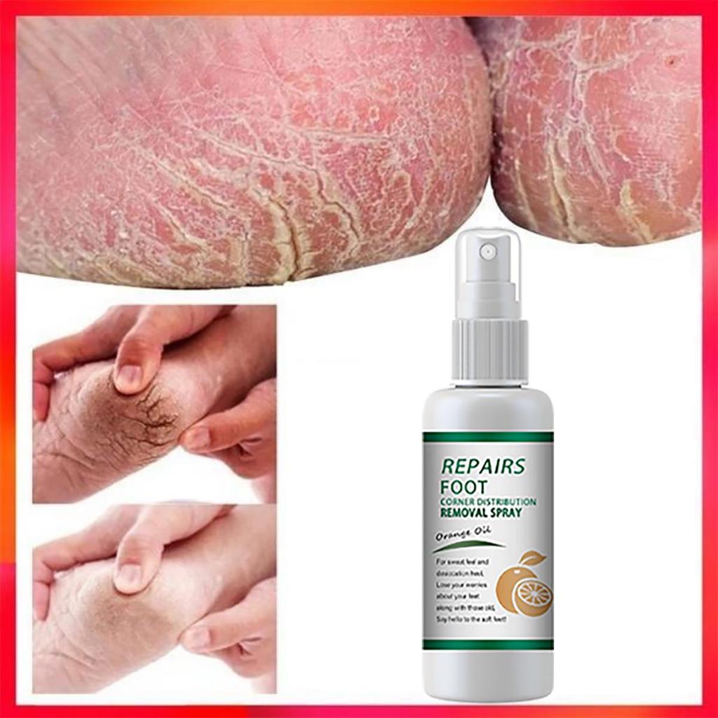 TRSTAY Maschera idratante per mani e piedi per una pelle morbida e liscia, con crema per i piedi per una cura extra