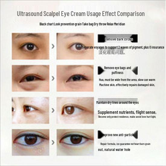 Anti-Wrinkle Eye Cream: Reduces Fine Lines, Bags, Tear Troughs & Crow's Feet; Moisturizes, Fades Dark Circles, Lifts & Firms