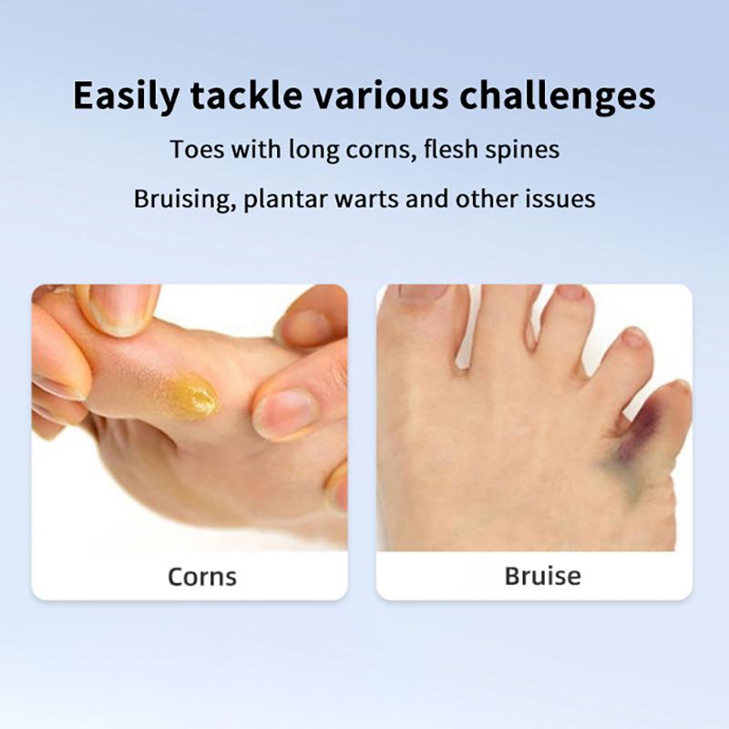 4PCs Soft Silicone Corn and Callus Pads – Medical-Grade Protective Patches for Foot and Toe Pain Relief and Skin Care
