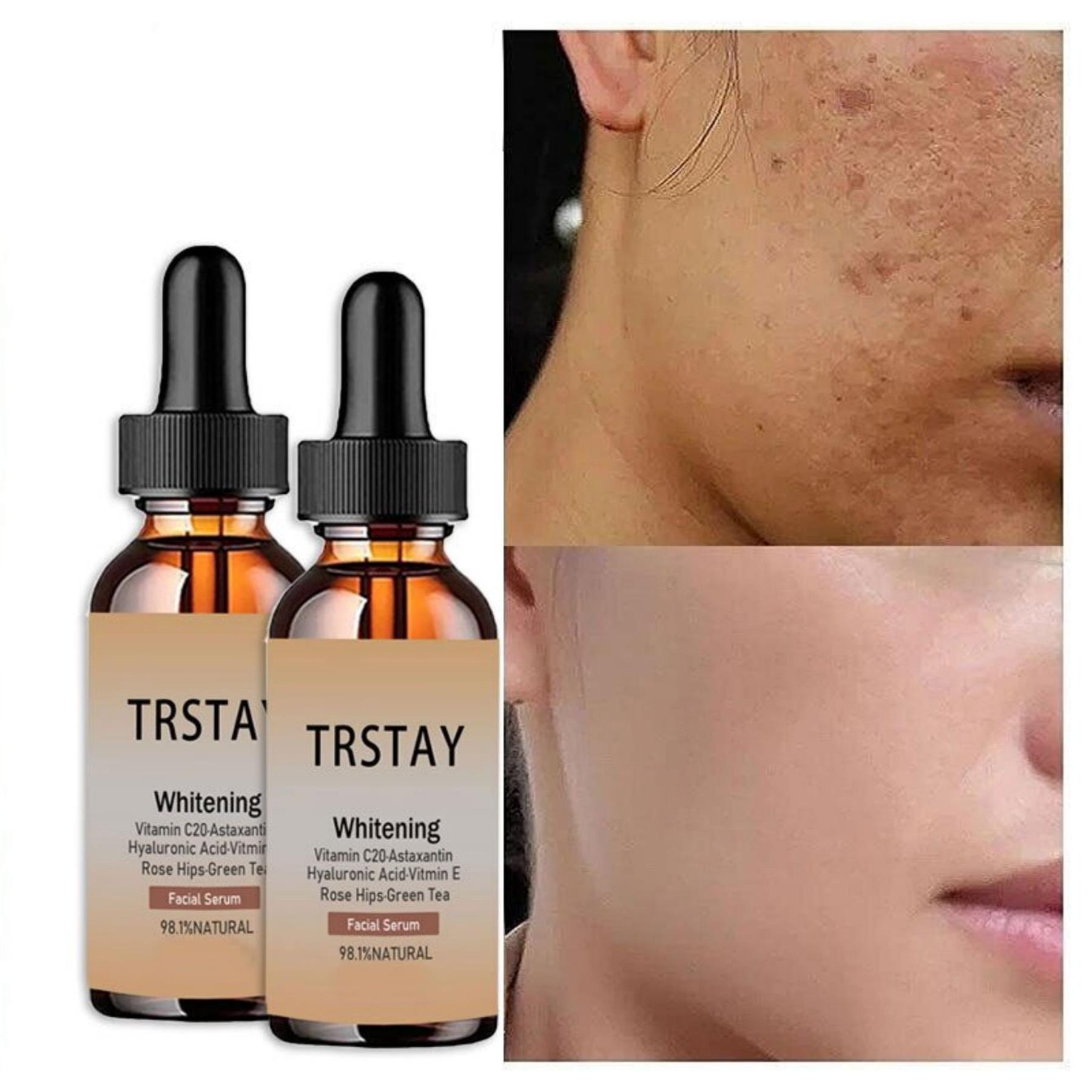 

Сыворотка для сужения пор, удаление больших пор, подтяжка, отбеливание, восстановление пор на лице, минимизация эссенции для ухода за кожей, красота