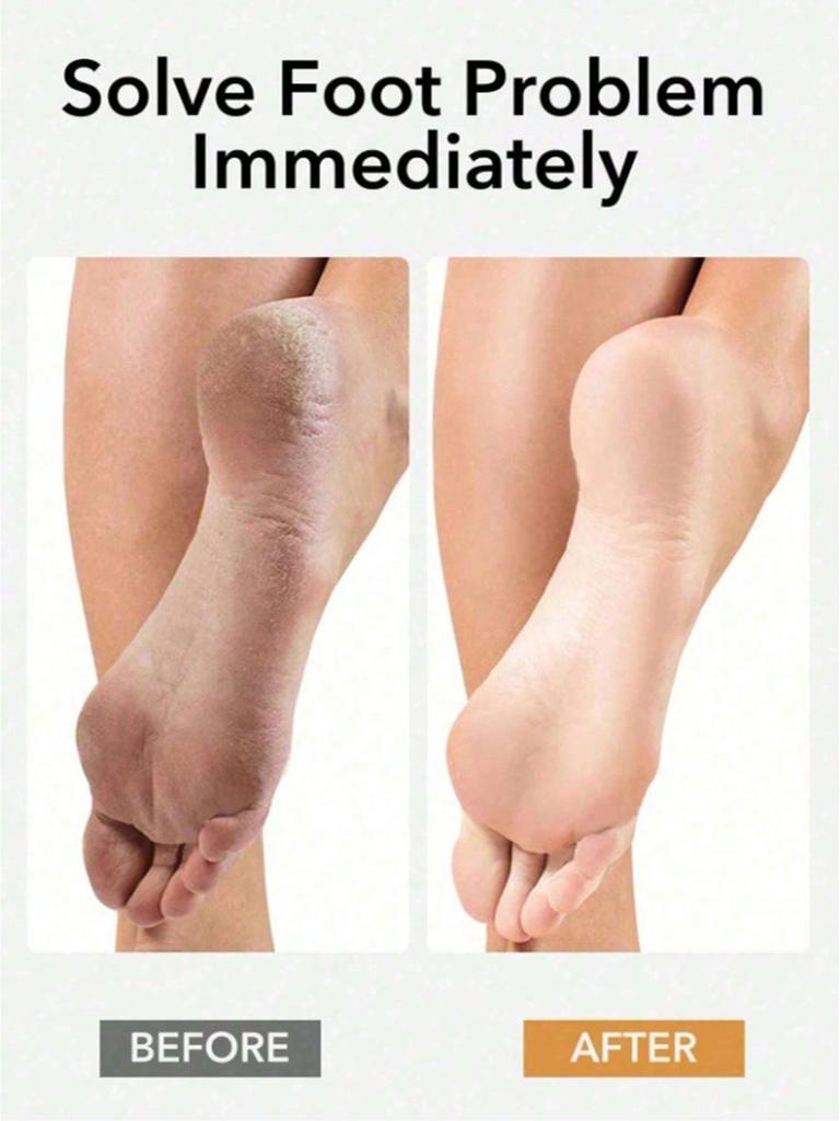 1 Pc Professional Foot File With Handle, Deep Exfoliating Callus Remover, Home SPA Care, Say Goodbye To Rough Feet