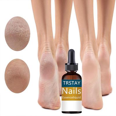 Nail Miracle: Hardening, Preventing Fragmentation, Injected With Odorless Natural Keratin, Bringing Luster