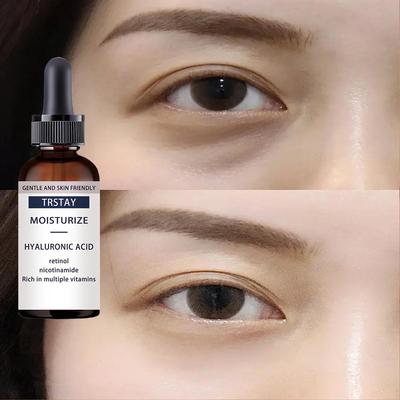 Eye Cream Remove Eye Bags Puffiness Dark Circles Whitening Moisturizing Eyes Skin Care Face Care