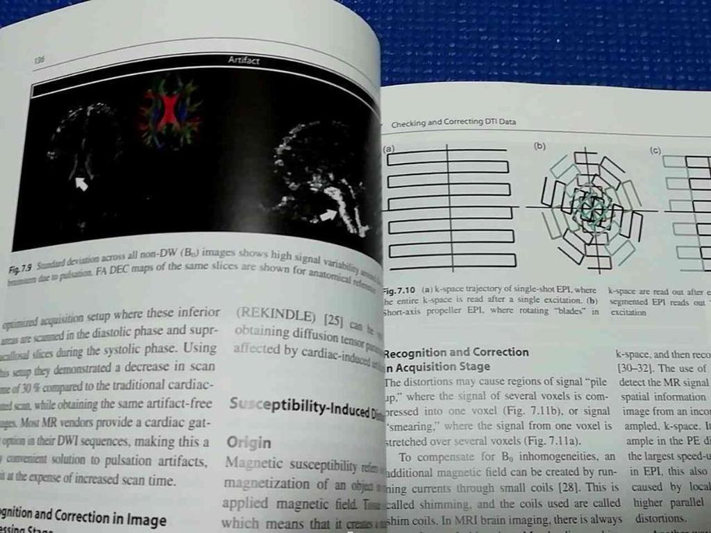 [USED] Diffusion Tensor Imaging Books