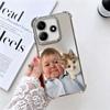 Funny Babaite Hasbulla Plating Phone Case For Xiaomi Redmi Note 14 15 Pro Plus 13 12 11 11S 11T 10 9S 9 5G Anti-Fall Airabag Cov