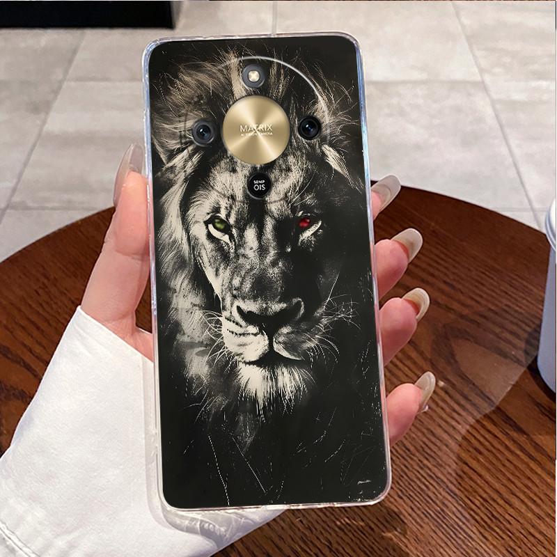 For Honor X9d 2025 Case Clear Luxury Cute Love Rabbit Funny TPU Soft Silicone Phone Case For Honor X9d 5G Transparent Back Cover