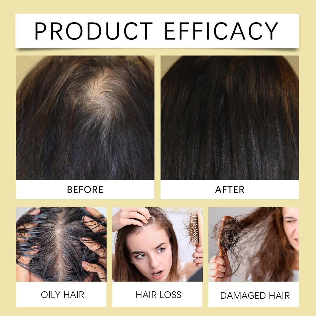 Шампунь-мыло эффективно очищает волосы и кожу головы, подходит для всех типов волос. Постоянное использование восстанавливает здоровье волос