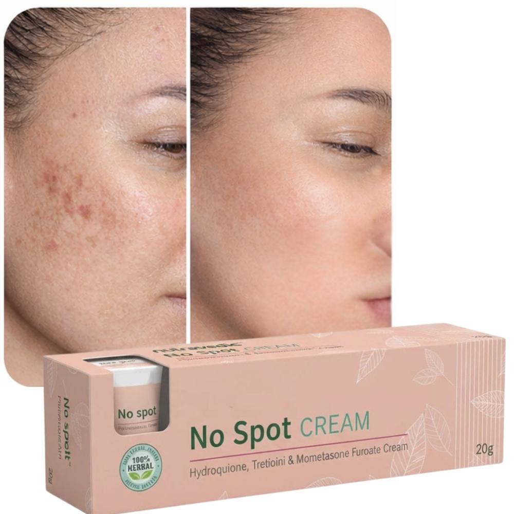 Dark Spot Corrector Skin Whitening Fade No Spot Cream 50g | Lightening Blemish Removal Gel, Reduces Age Spot and Black Spots