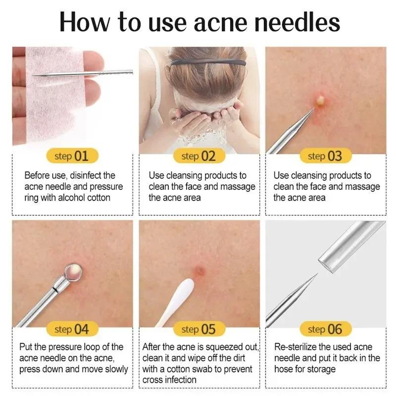 3-8pcs Acne Needle Remove Blackhead Comedone Extractor Tools Stainless Steel Facial Skin Care Tool Pimple Blemish Removal Tools