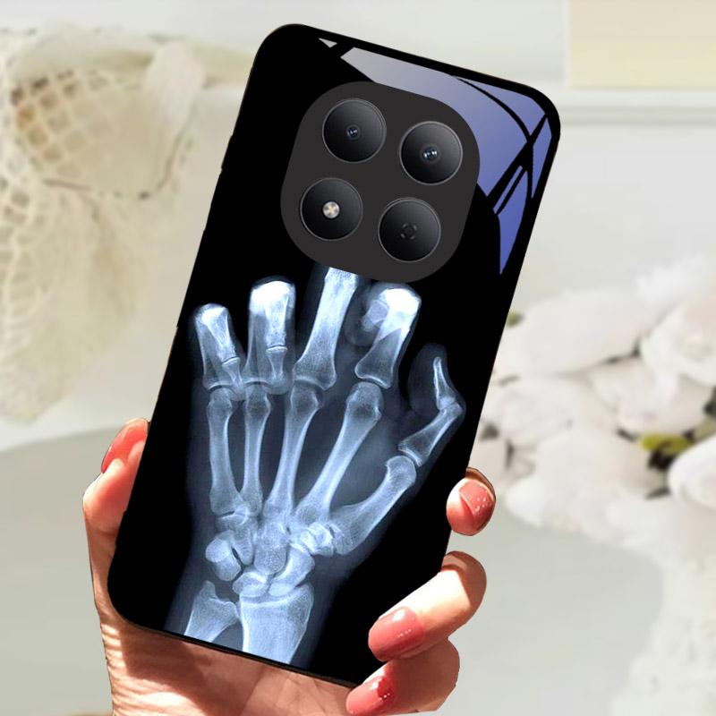 For Xiaomi Redmi Note 15 Pro 5G Case Tempered Glass Phone Cover For Redmi Note15 Pro 15Pro 5G Coque Note15Pro Camera Protector