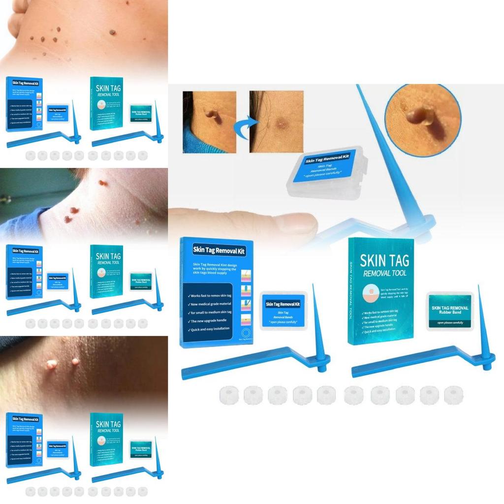 Effective Skin Tag Removal Tag Refill Band Set With 10 Pieces For Smooth Skin
