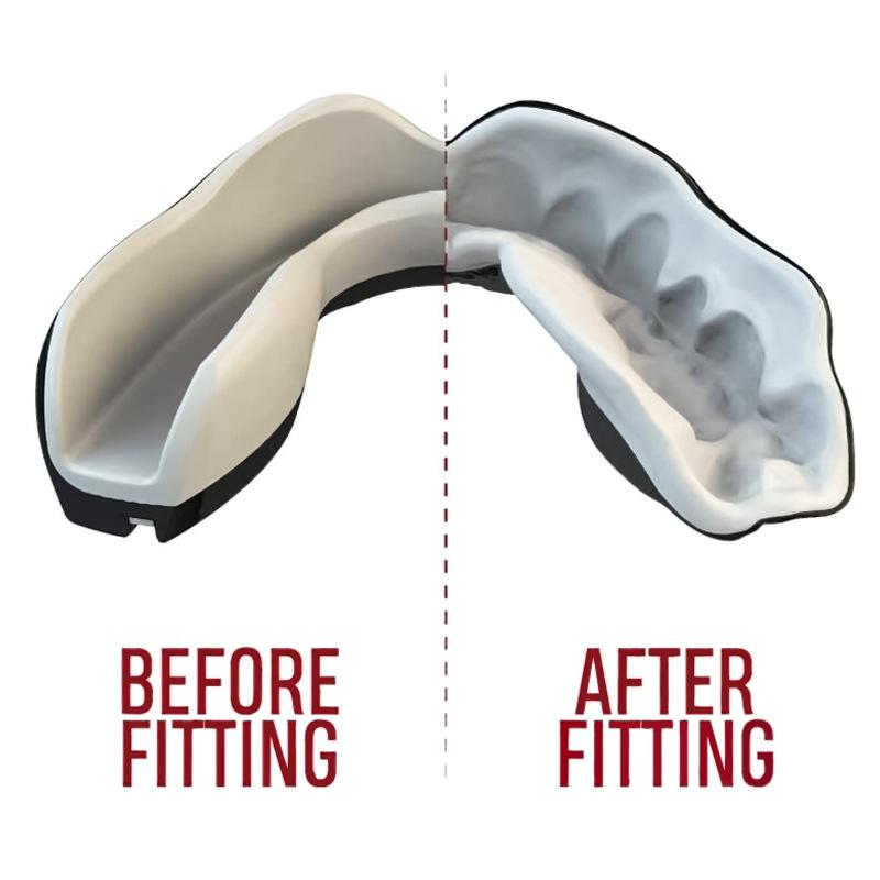 1Pc 3D Teeth Pattern Boxing Mouth Guard Fit Adults With Case Mouth Guard For Sanda Boxing And All Ball Sports