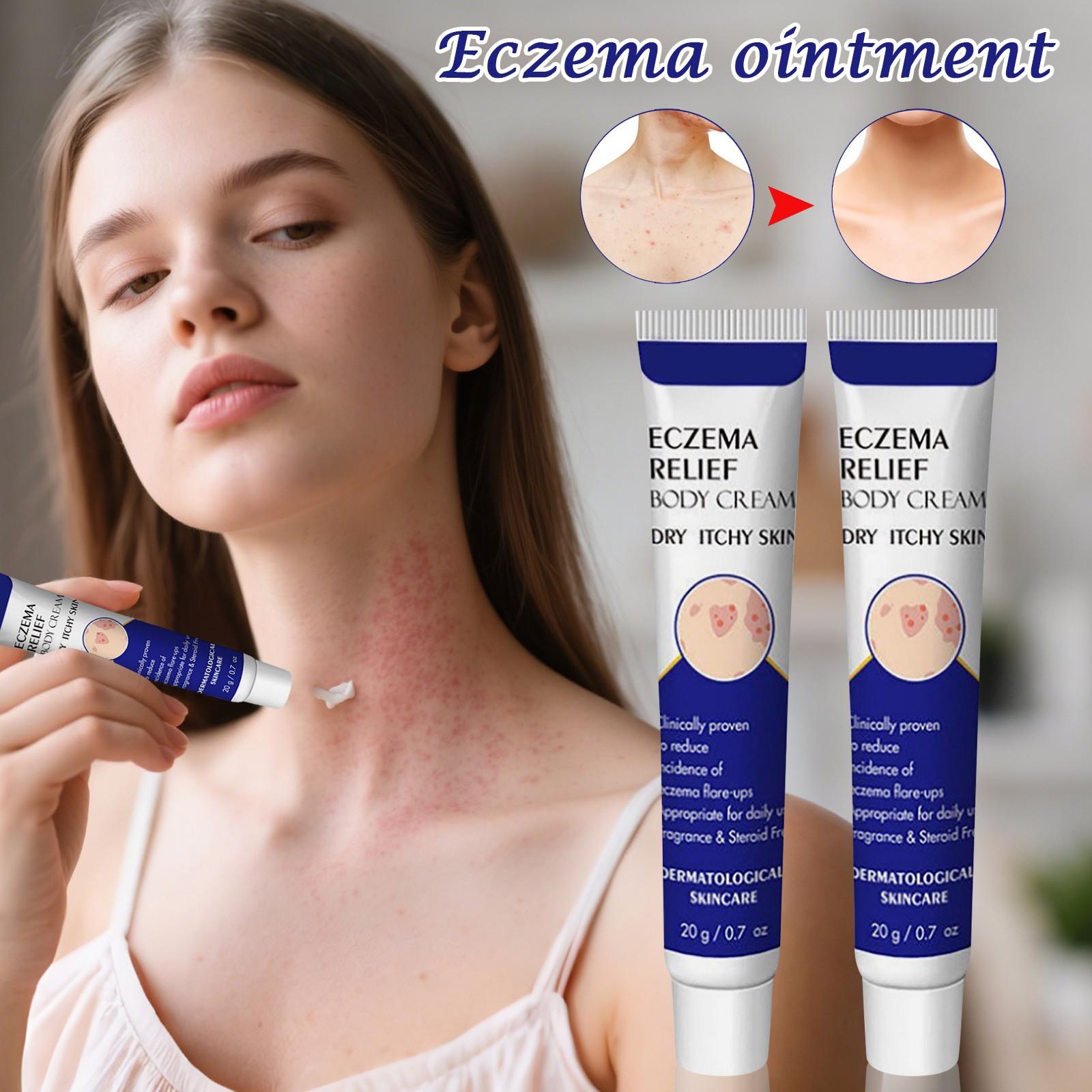 

Крем от экземы 20 г, Крем от зуда и грибка, Крем для ухода за кожей для облегчения зуда и успокоения кожи One Size