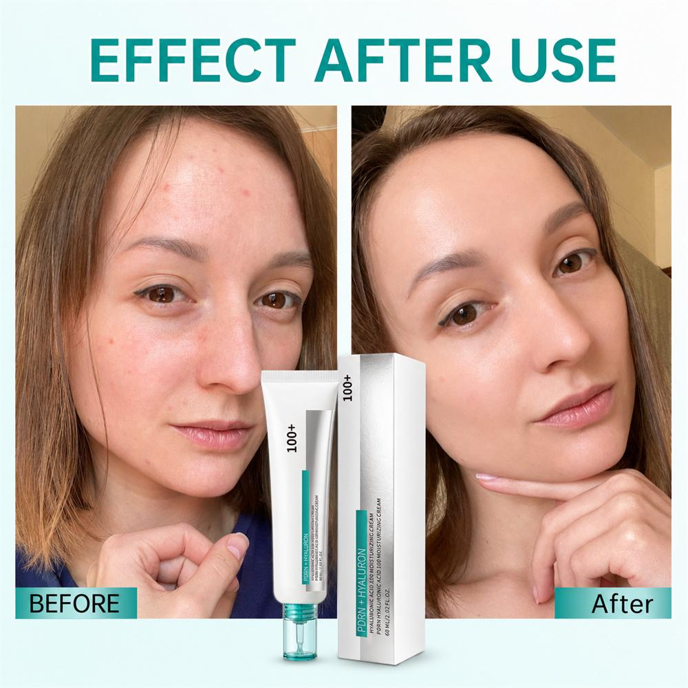 Hyaluronic Acid Moisturizing Cream Gentle and Nourishing Caring for Facial Skin Refreshing Daily Moisturizing Skincare Cream
