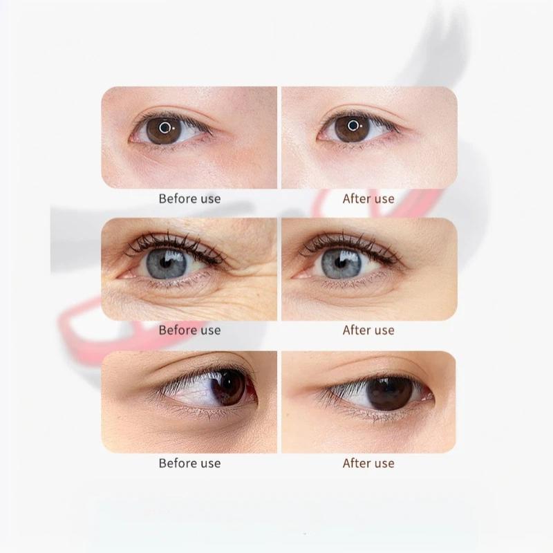 1 Set 3D Red Light Eye Fatigue Dark Circles Relaxing Under-Eye Glasses Massage Beauty Machine Smart Eye Massager