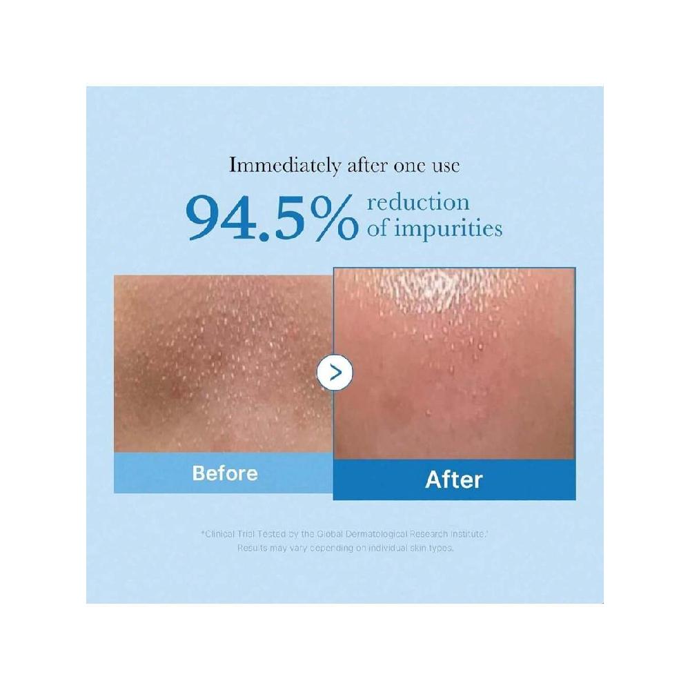 Medicube Zero Pore Blackhead Dyprensende Olje 205ml Sminkefjerner For Alle Hudtyper, Daglig Fuktighetsgivende Ansiktsrens, Lavirriterende