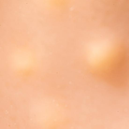 Man Hoofd Puistjes Knijpen Speelgoed met Pincet Angst Stressverlichting Acne Knijpen Reiniging Fidget Speelgoed Mee-eters Verwijdering Decompressie Sensorisch Speelgoed