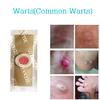 Foot Corn Remover Plaster Foot Pad Patches  Patch Pain Foot Care Tools