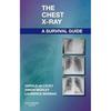 La Radiographie Thoracique: Un Guide de Survie broché UKN315