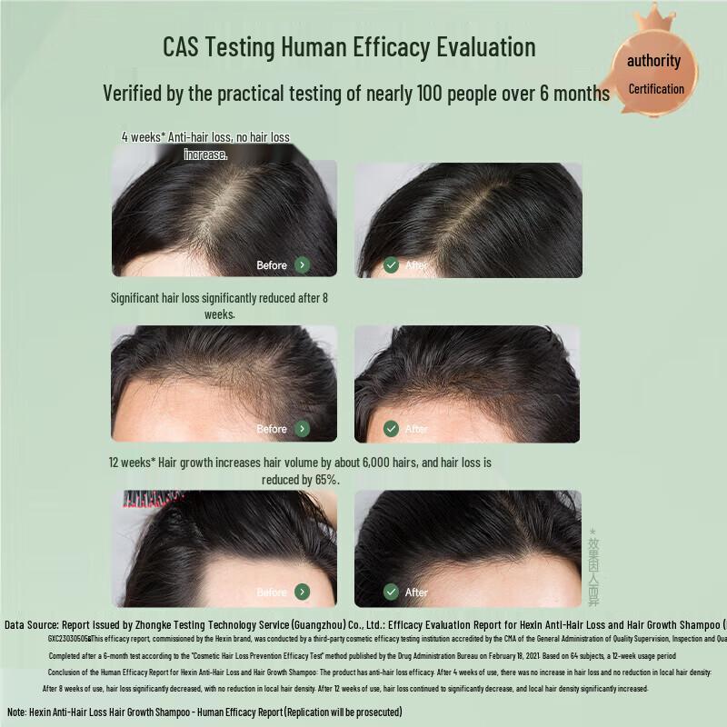 Hexin Anti-Hair Loss Hair Growth Shampoo Set