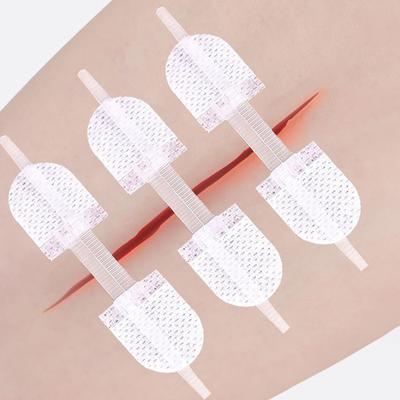 Correia Zíper Fecho de Feridas Patches Respirável Sem Costura Elástico Zip Suturas Bandagens Para Cuidados com Feridas Aparelhos Suportes