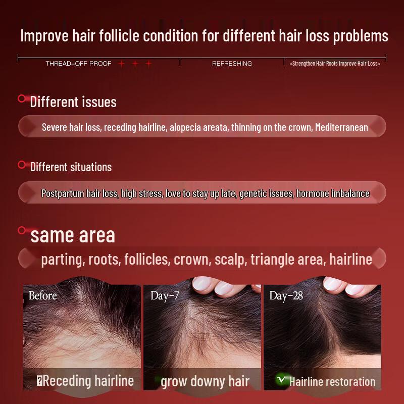 Vitress Anti-Hair Loss Hair Growth Liquid