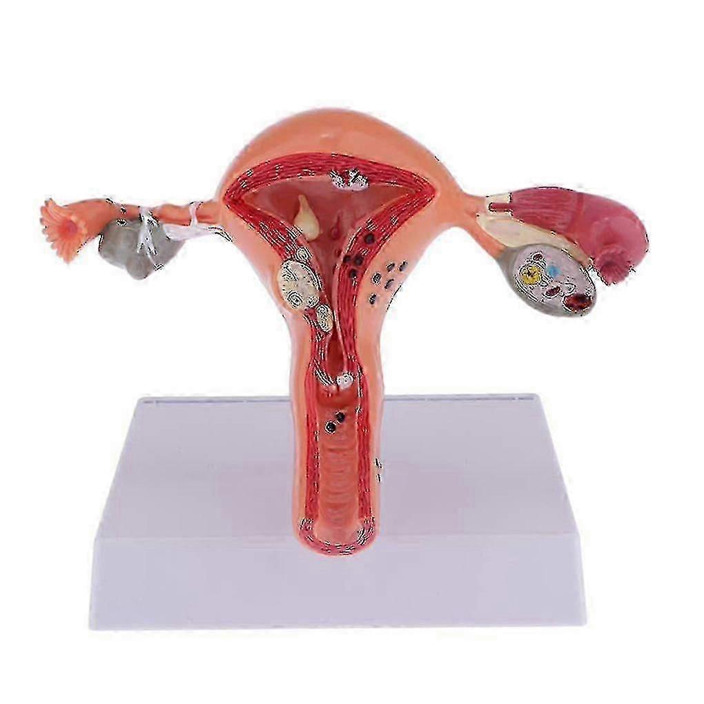 Female Uterus Structure Biological Models Educational Experiment o