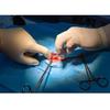 GDC Allis Forceps Baby-4x5 (12.5cm) (TFB)