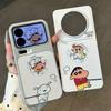 Couple leash Xiaoxin Xiaobai is suitable for Apple iPhone16/17Pro mobile phone case 15 electroplated large window 14 sets