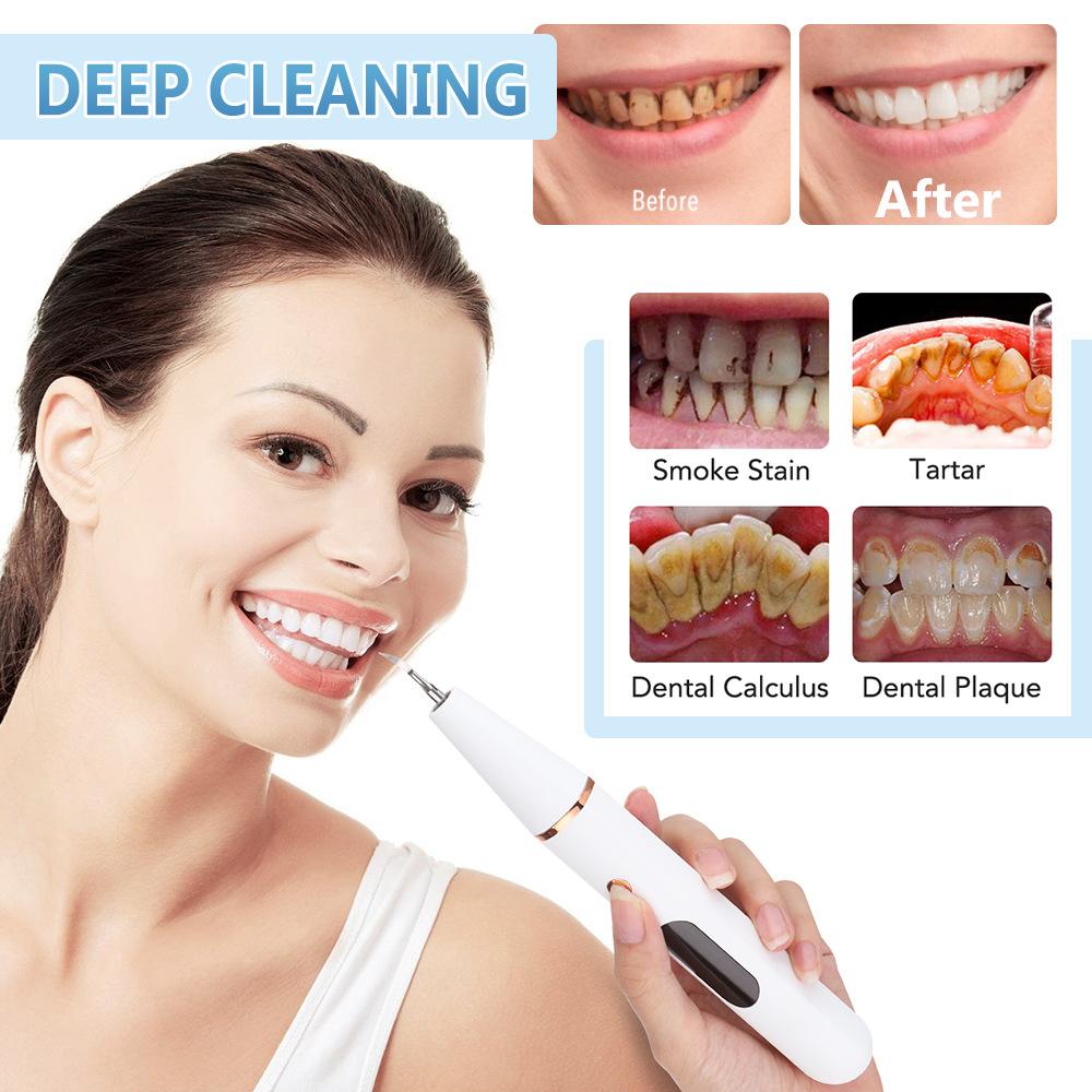 Electric Irrigator Dental?Teeth Whitening USB Rechargable Oral?Care Cleaning Device