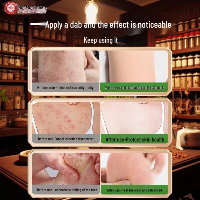 DAGO Fungal King Skin & Foot Relief Cream