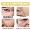 Die sanfte und nicht reizende Retinol Anti-Aging Feuchtigkeitscreme spendet Feuchtigkeit und hellt den Teint auf, sodass die Haut weich und verfeinert bleibt.