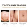 5G/15G/30G/50G/Pregnant Women's Belly Line Cream for Preventing Postpartum Pregnancy Lines Repair Cream