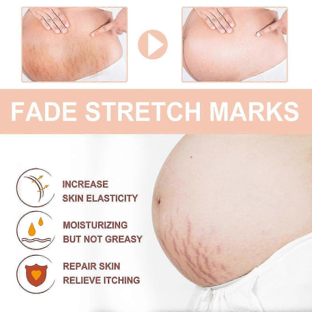 Wiieey Snail Essence Pregnancy Cream Firming Skin Repair Fading Postpartum Pregnancy Marks Pregnancy Obesity Wrinkle Cream Lotion & Moisturizer1pcs) -