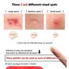 Elizavecca - Witch Piggy Hell Pore Blemish Spot Patch