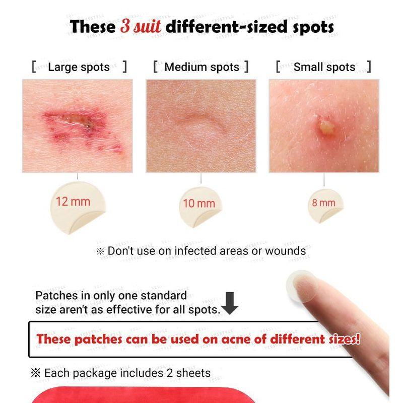 Elizavecca - Witch Piggy Hell Pore Blemish Spot Patch