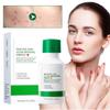 Sérum à l'Acide Salicylique 35ml Traitement de l'Acné Essence Visage Formule Nettoyante Pores Contrôle du Sébum Hydratant Pour Tous les Traitements de Peau