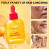 1 Bottle Vitamin C Serum | Brightening Serum, Facial Care, Strengthen Skin Barrier, Brighten Complex