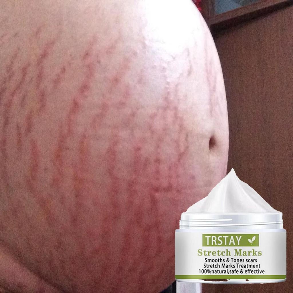 Těhotné ženy opravují rýhy na břiše, tělový krém proti vyblednutí, hydratují produkty péče o pleť, odstraňují těhotenské vrásky, tukové rýhy, krém na obličej
