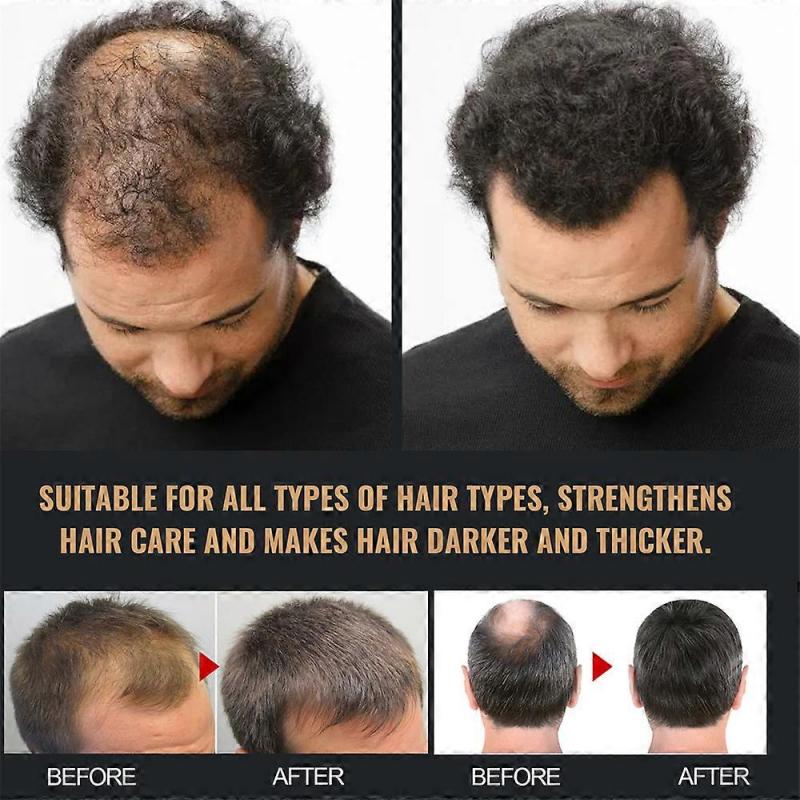Spartan Shampoo Spartan Root Activator Shampoo Natürliche Haarwuchs Shampoos