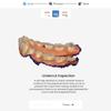 Dental Intraoral Heyinscan S3 Scanner 3D Display Intraoral Oral Camera Dental Laboratory Equipment Impression Instrument