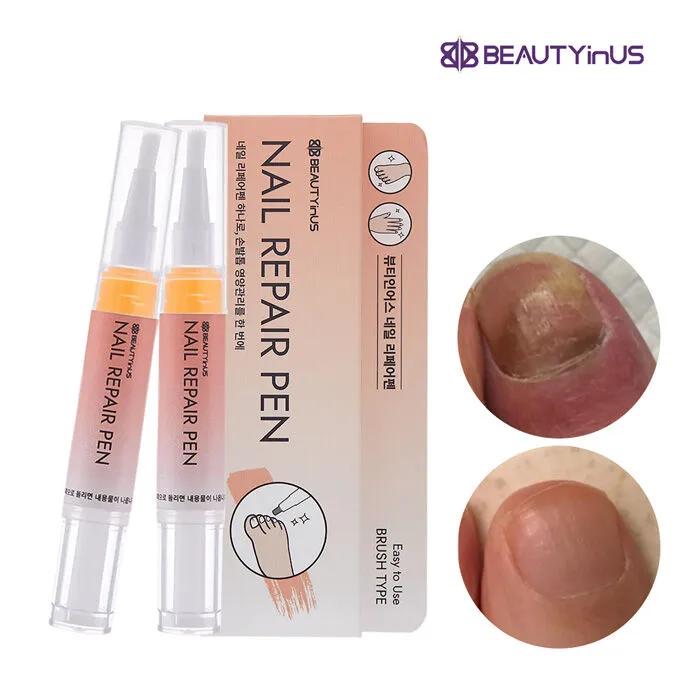 

Ручка для ремонта ногтей