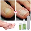 Ingrown Toenails Physical Correcting Elastic Patches Pedicure Tool Kit Correction Set