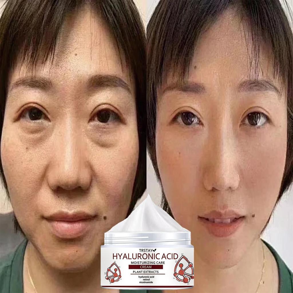 A Moisturizing Cream That Improves Skin Elasticity, Brightens Skin Tone, Helps Reduce Wrinkles, and Absorbs Quickly