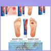 Ximonth 20g Deeply Moisturizing Nourishing Foot Cream For Skin Relief