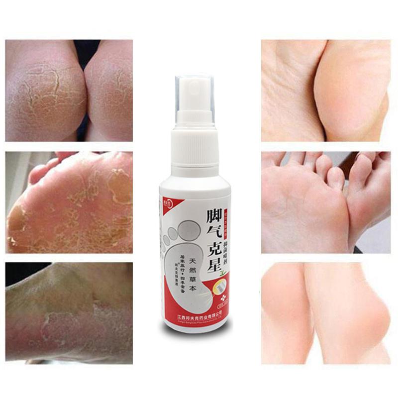 Foot Odor and Sweat Spray Foot Gas Spray Foot Itch Peeling and Antiperspirant Cleaning Feet Care Liquid Personal Health Care NO BOX