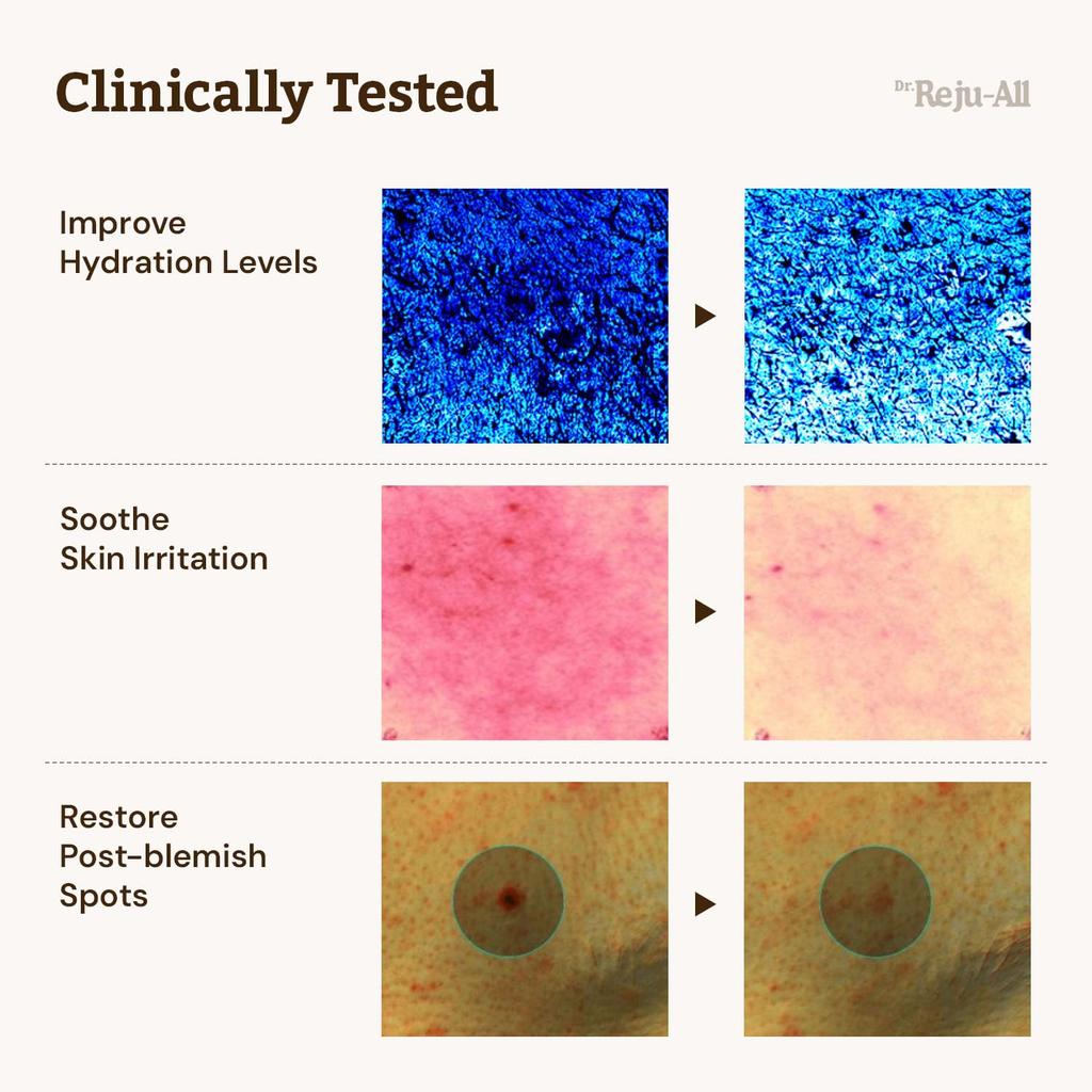 Dr. RejuAll Zaawansowany Krem Odmładzający PDRN 30ml